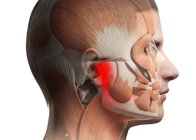 TMJ Disorder Therapy